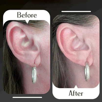 Premium Invisible Earlobe Patches – 100 PCS
