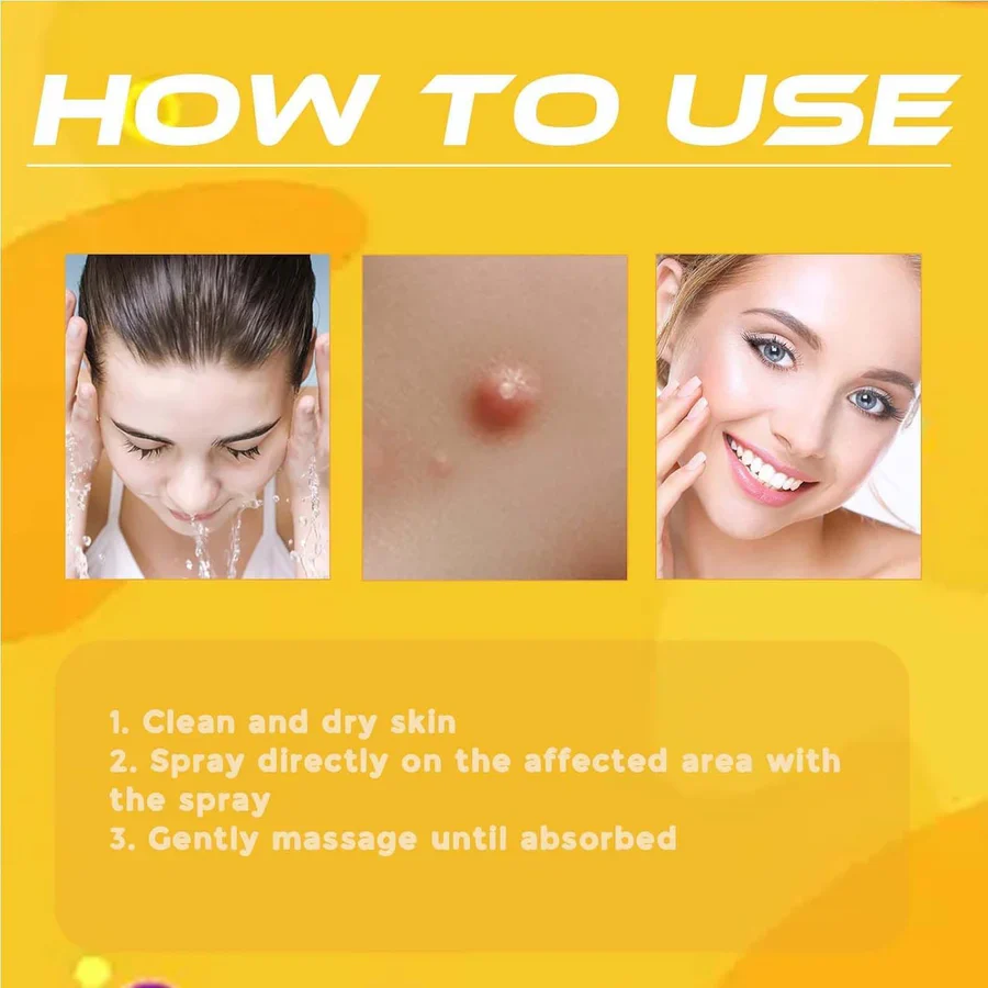 Herbal Wart & Skin Tag Remover ( 🔥 Buy 1 Get 1 FREE )
