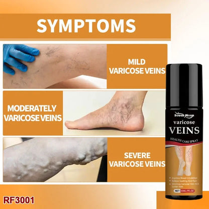 Vein Healing Varicose Veins Treatment Spray Pack of 2