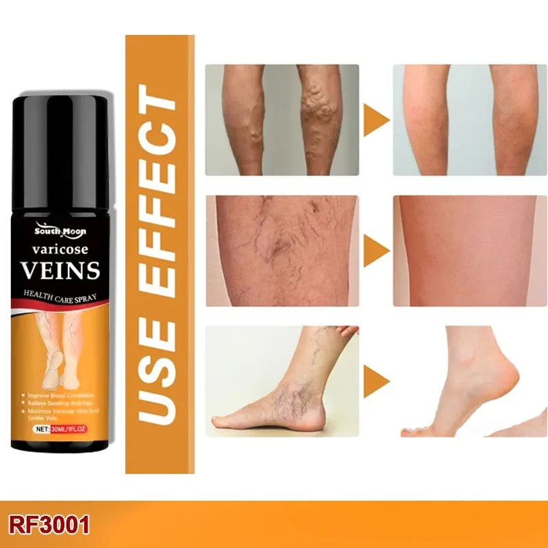 Vein Healing Varicose Veins Treatment Spray Pack of 2