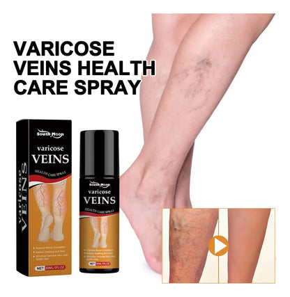 Vein Healing Varicose Veins Treatment Spray Pack of 2
